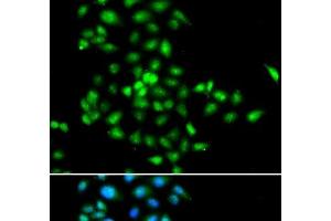 Immunofluorescence analysis of MCF-7 cells using SBDS Polyclonal Antibody (SBDS anticorps)