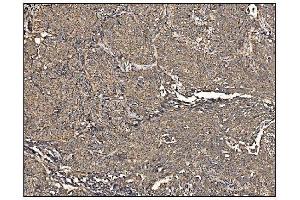 IHC analysis of Arginine Decarboxylase/AZIN2 using anti-Arginine Decarboxylase/AZIN2 antibody (ABIN7599403). (ADC anticorps  (AA 1-448))
