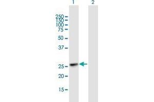 Western Blot analysis of KIAA1109 expression in transfected 293T cell line by KIAA1109 MaxPab polyclonal antibody. (Fetal Sulfoslycoprotein Antigen (FSA) (AA 1-191) anticorps)