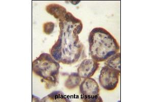 CGB/HCG-Beta Antibody (C-term) (ABIN656960 and ABIN2846144) immunohistochemistry analysis in formalin fixed and paraffin embedded human placenta tissue followed by peroxidase conjugation of the secondary antibody and DAB staining. (CGB anticorps  (C-Term))