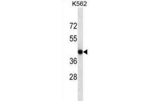 Western Blotting (WB) image for anti-Calcium Channel, Voltage-Dependent, gamma Subunit 4 (CACNG4) antibody (ABIN2997002)
