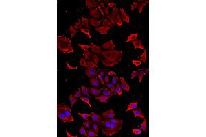 Immunofluorescence analysis of HeLa cell using TCAP antibody. (TCAP anticorps)