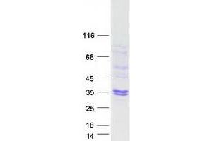 Validation with Western Blot