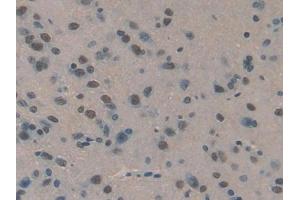 DAB staining on IHC-P; Samples: Rat Brain Tissue (SERPIND1 anticorps  (AA 25-235))