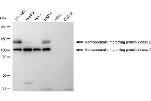 Western blotting analysis using Homeodomain interacting protein kinase 2 antibody (ABIN7798996).