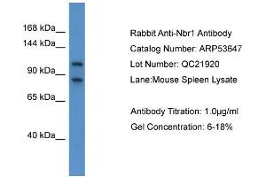 WB Suggested Anti-Nbr1  Antibody Titration: 0. (NBR1 anticorps  (C-Term))