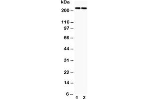 Western blot testing of Dicer antibody and Lane 1:  HeLa;  2: MCF-7 (DICER1 anticorps  (AA 1-195))