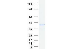 Validation with Western Blot