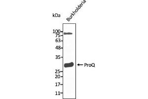 Western Blotting (WB) image for anti-ProQ antibody (ABIN7272983) (ProQ anticorps)