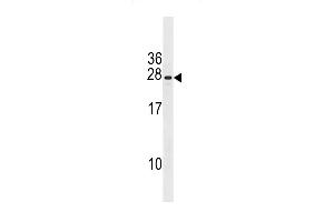 CXorf41 Antibody (C-term) (ABIN1881246 and ABIN2843203) western blot analysis in NCI- cell line lysates (35 μg/lane). (PIH1D3 anticorps  (C-Term))
