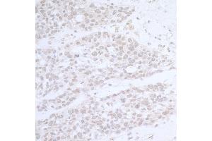 Immunohistochemistry (IHC) image for anti-RNA Polymerase-Associated Protein CTR9 Homolog (CTR9) (AA 1123-1173) antibody (ABIN7453428) (CTR9 anticorps  (AA 1123-1173))