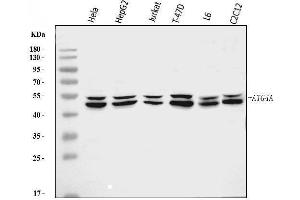 Western blot analysis of ATG4A using anti-ATG4A antibody (ABIN7599354).