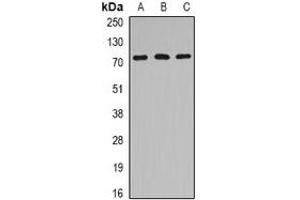 Western blot analysis of HSPA6 expression in Jurkat (A), mouse heart (B), rat brain (C) whole cell lysates. (HSPA6 anticorps)