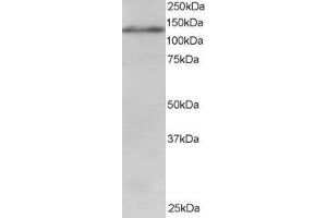 ABIN185009 staining (1µg/ml) of Jurkat lysate (RIPA buffer, 30µg total protein per lane). (USP11 anticorps  (C-Term))