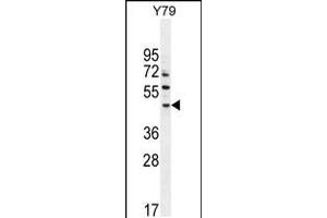 Western blot analysis in Y79 cell line lysates (35ug/lane). (LACE1 anticorps  (N-Term))