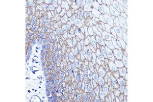 Immunohistochemistry of paraffin-embedded human esophageal using S100 Rabbit pAb (ABIN6128693, ABIN6147339, ABIN6147340 and ABIN6214636) at dilution of 1:100 (40x lens). (S100A14 anticorps  (AA 1-104))