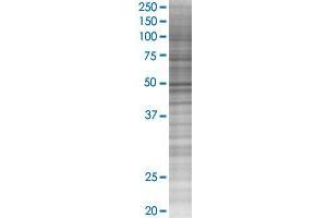 CYP2A7 transfected lysate. (CYP2A7 293T Cell Transient Overexpression Lysate(Denatured))