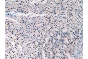 IHC-P analysis of Mouse Stomach Tissue, with DAB staining. (TALDO1 anticorps  (AA 35-285))