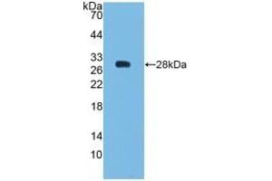Detection of Recombinant Bcl2, Human using Polyclonal Antibody to B-Cell Leukemia/Lymphoma 2 (Bcl2) (Bcl-2 anticorps  (AA 2-211))