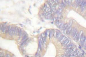Image no. 1 for anti-Somatostatin (SST) antibody (ABIN271820) (Somatostatin anticorps)
