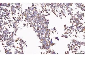 IHC analysis of PP11/ENDOU using anti-PP11/ENDOU antibody (ABIN7600552). (ENDOU anticorps  (AA 20-386))