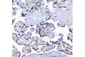 IHC analysis of splicing factor 1 using anti-splicing factor 1 antibody .
