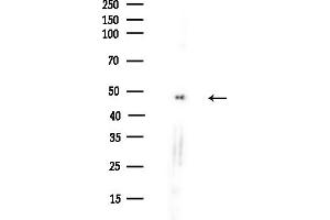 anti-Aldehyde Dehydrogenase 9 Family, Member A1 (ALDH9A1) (C-Term) antibody