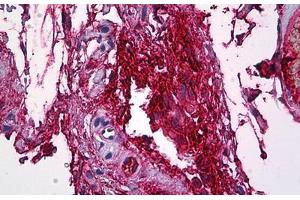 Human Intravascular Plasma: Formalin-Fixed, Paraffin-Embedded (FFPE) (FGG anticorps  (AA 31-130))