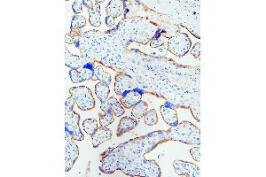 IHC analysis of EGFR using anti-EGFR antibody (ABIN5518909). (EGFR anticorps  (N-Term))