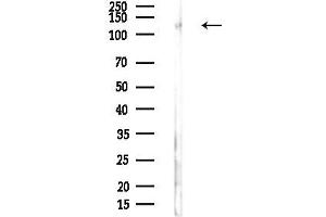 Western blot analysis of lysates from PC12 cells, using SMARCC1 Antibody at 1/1000 dilution.