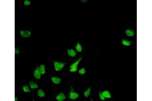 Immunofluorescence of monoclonal antibody to PHB on HeLa cell.