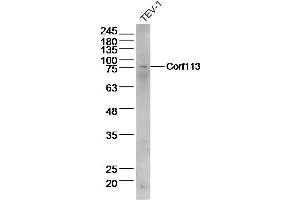 Lane 1: Tev-1 lysates probed with C1orf113 Polyclonal Antibody  at 1:300 overnight at 4˚C. (SH3D21 anticorps  (AA 51-150))