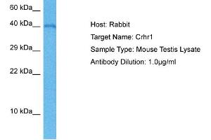 Host: Mouse Target Name: CRHR1 Sample Tissue: Mouse Testis Antibody Dilution: 1ug/ml (CRHR1 anticorps  (C-Term))