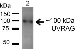 Western blot analysis of Rat Liver showing detection of ~100kDa UVRAG protein using Rabbit Anti-UVRAG Polyclonal Antibody .