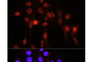 Immunofluorescence analysis of NIH-3T3 cells using Phospho-YAP1(S127) Polyclonal Antibody at dilution of 1:100 (40x lens). (YAP1 anticorps  (pSer127))