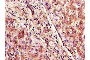 Immunohistochemistry of paraffin-embedded human liver tissue using ABIN7170291 at dilution of 1:100