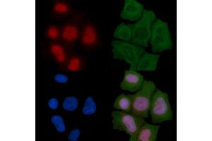 ABIN6266140 and ABIN6272491 staining Hela cells(45 min of heat-shock) by IF/ICC.