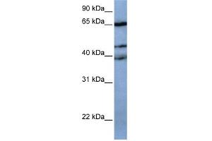 WB Suggested Anti-ZNF681 Antibody Titration:  0. (ZNF681 anticorps  (N-Term))