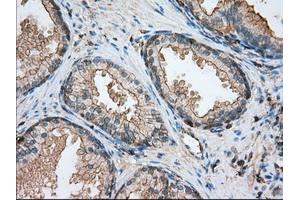 Immunohistochemistry (IHC) image for anti-Aldehyde Dehydrogenase 3 Family, Member A1 (ALDH3A1) antibody (ABIN1496591) (ALDH3A1 anticorps)