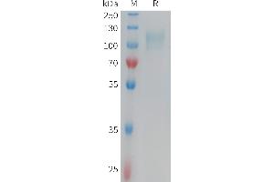 Human CD62E Protein, His Tag on SDS-PAGE under reducing condition.
