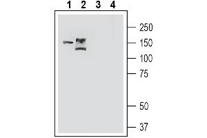Western blot analysis of mouse colon lysate (lanes 1 and 3) and  rat eye lysate (lanes 2 and 4): 1-2. (TMC1 anticorps  (Extracellular))