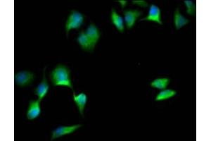 Immunofluorescence staining of Hela Cells with ABIN7127821 at 1:50, counter-stained with DAPI. (Recombinant SOX1 anticorps)