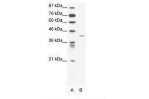 Image no. 1 for anti-Somatostatin Receptor 4 (SSTR4) (AA 163-212) antibody (ABIN202399) (SSTR4 anticorps  (AA 163-212))