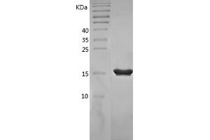 Western Blotting (WB) image for Tumor Necrosis Factor alpha (TNF alpha) (AA 80-235) (Active) protein (His tag) (ABIN7125540)
