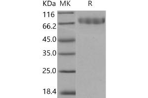 Western Blotting (WB) image for C-Type Lectin Domain Family 14, Member A (CLEC14A) protein (His tag) (ABIN7320328)