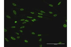 Immunofluorescence of purified MaxPab antibody to HNRNPUL1 on HeLa cell. (HNRNPUL1 anticorps  (AA 1-804))