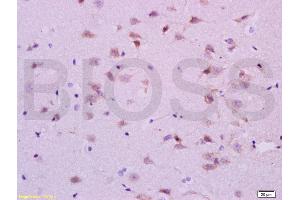 Formalin-fixed and paraffin embedded rat brain labeled with Anti-5-HTR1A/HTR1A Polyclonal Antibody, Unconjugated (ABIN738006) at 1:200 followed by conjugation to the secondary antibody and DAB staining. (Serotonin Receptor 1A anticorps  (AA 301-400))