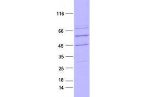 Validation with Western Blot