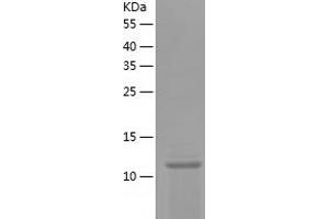 Western Blotting (WB) image for Angiopoietin 4 (ANGPT4) (AA 25-144) protein (His-IF2DI Tag) (ABIN7121828)