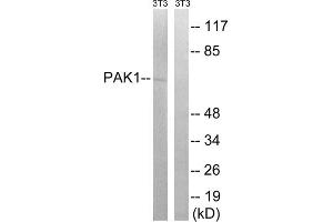 Western blot analysis of extracts from 3T3 cells, treated with UV (15mins), using PAK1 (epitope around residue 204) antibody. (PAK1 anticorps  (Ser204))